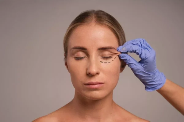 تجميل جفن العين