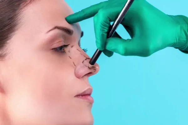 تجميل مقدمه الأنف