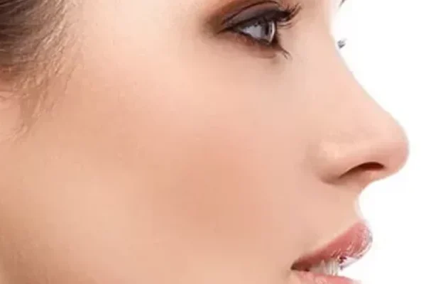 جراحه الأنف الثانويه
